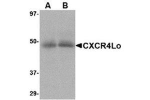 Western blot analysis of CXCR4 in (A) human spleen and (B) human thymus tissue lysate with AP30268PU-N CXCR4-Lo antibody at 10 μg/ml.