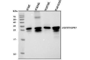 Western blot analysis of Hsp27 using anti-Hsp27 antibody (ABIN6719322).