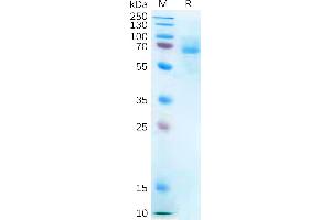 Human P2RX7 Protein, hFc Tag on SDS-PAGE under reducing condition.