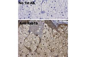 Immunohistochemistry (IHC) image for anti-RAB1B, Member RAS Oncogene Family (RAB1B) (C-Term) antibody (ABIN6254186) (RAB1B anticorps  (C-Term))