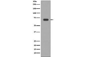 Western blot analysis of Alas1 expression in HepG2 cell lysate. (Recombinant ALAS1 anticorps)