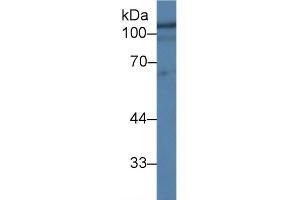 Detection of HEXb in Human Hela cell lysate using Polyclonal Antibody to Hexosaminidase B Beta (HEXb) (HEXB anticorps  (AA 122-311))