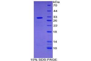 SDS-PAGE analysis of Mouse SHB Protein. (Src Homology 2 Domain Containing Adapter Protein B Protéine)