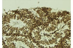 ABIN6273696 at 1/100 staining Mouse testis tissue by IHC-P. (SETDB2 anticorps  (N-Term))