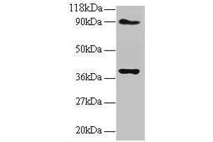 Western blot All lanes: NDUFS5 antibody at 2 μg/mL Lane 1: EC109 whole cell lysate Lane 2: 293T whole cell lysate Secondary Goat polyclonal to rabbit IgG at 1/15000 dilution Predicted band size: 13 kDa Observed band size: 40 kDa