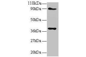 Western blot All lanes: NDUFS5 antibody at 2 μg/mL Lane 1: EC109 whole cell lysate Lane 2: 293T whole cell lysate Secondary Goat polyclonal to rabbit IgG at 1/15000 dilution Predicted band size: 13 kDa Observed band size: 40 kDa (NDUFS5 anticorps  (AA 2-106))
