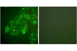 Immunofluorescence analysis of A549 cells, using Connexin 43 Antibody. (Connexin 43/GJA1 anticorps  (AA 333-382))