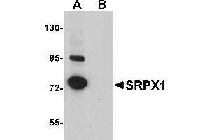 Western Blotting (WB) image for anti-Sushi-Repeat Containing Protein, X-Linked (SRPX) (N-Term) antibody (ABIN1031585) (SRPX anticorps  (N-Term))