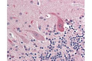 Anti-OSMR antibody IHC staining of human brain, cerebellum. (Oncostatin M Receptor anticorps  (AA 612-661))