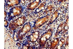 Immunohistochemistry of paraffin-embedded human small intestine tissue using ABIN7162833 at dilution of 1:100 (FKBP3 anticorps  (AA 2-224))
