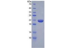 SDS-PAGE of Protein Standard from the Kit (Highly purified E. (TNF alpha Kit ELISA)