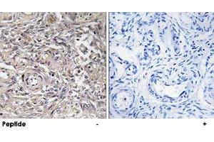Immunohistochemistry analysis of paraffin-embedded human ovary tissue using CLDN6 polyclonal antibody . (Claudin 6 anticorps)