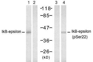 Western blot analysis of extract from 293 cells, untreated or treated with TNF-α (20ng/ml, 15min), using IkB-ε (Ab-22) antibody (E021296, Lane 1 and 2) and IkB-ε (Phospho-Ser22) antibody (E011213, Lane 3 and 4). (NFKBIE anticorps)