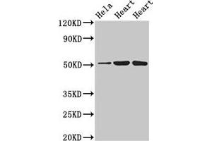 Western Blot Positive WB detected in: Hela whole cell lysate, Rat heart tissue, Mouse heart tissue All lanes: ATP1B1 antibody at 3 μg/mL Secondary Goat polyclonal to rabbit IgG at 1/50000 dilution Predicted band size: 36, 35 kDa Observed band size: 52 kDa (ATP1B1 anticorps  (AA 64-241))