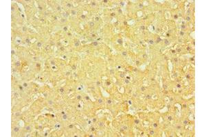 Immunohistochemistry of paraffin-embedded human liver tissue using ABIN7151877 at dilution of 1:100