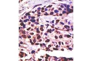 Image no. 2 for anti-Ubiquitin Specific Peptidase 25 (USP25) (C-Term) antibody (ABIN357563) (USP25 anticorps  (C-Term))