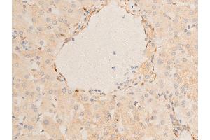 ABIN6267220 at 1/100 staining human liver tissue sections by IHC-P.