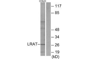 Western Blotting (WB) image for anti-Lecithin Retinol Acyltransferase (Phosphatidylcholine--Retinol O-Acyltransferase) (LRAT) (Internal Region) antibody (ABIN1849061) (LRAT anticorps  (Internal Region))