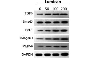 Lumican promotes the expression of protein level in fibrosis.