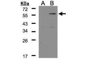 WB Image Western Blot analysis of CPE expression in transfected 293T cell line by CPE polyclonal antibody. (CPE anticorps)