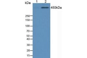 Detection of TP53BP1 in Human 293 Cells using Anti-Phosphorylated Tumor Protein p53 Binding Protein 1 (TP53BP1) Polyclonal Antibody