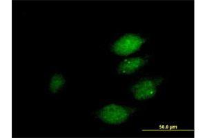 Immunofluorescence of purified MaxPab antibody to DUSP22 on HeLa cell.