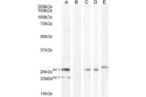 ABIN334524 (1ug/ml) staining of HEK293 iso 1 + iso 2 cell lysate (A) + peptide (B).