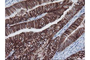 Image no. 4 for anti-FXYD Domain Containing Ion Transport Regulator 3 (FXYD3) antibody (ABIN1498341)