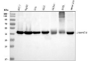 Western blot analysis of PMPCB using anti-PMPCB antibody (ABIN7600757). (PMPCB anticorps  (AA 23-479))