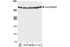 Western Blotting (WB) image for anti-HECT, UBA and WWE Domain Containing 1, E3 Ubiquitin Protein Ligase (HUWE1) (AA 2250-2300) antibody (ABIN7453584)