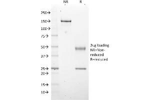 SDS-PAGE Analysis Purified EZH2 / KMT6 Mouse Monoclonal Antibody (EZH2/2536). (EZH2 anticorps)