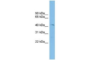 WB Suggested Anti-ETV7 Antibody Titration: 0. (ETV7 anticorps  (N-Term))