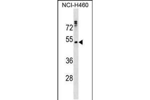 Western blot analysis in NCI-H460 cell line lysates (35ug/lane). (RHCG anticorps  (AA 184-213))