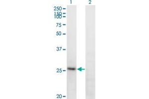 Western Blot analysis of FGA expression in transfected 293T cell line by FGA monoclonal antibody (M01), clone 1D12. (FGA anticorps  (AA 1-218))