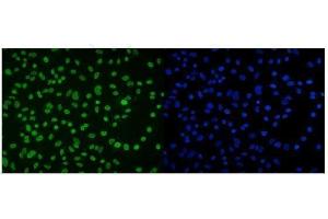 IF analysis of DDX5 using anti-DDX5 antibody (ABIN7602561). (DDX5 anticorps  (AA 85-328))