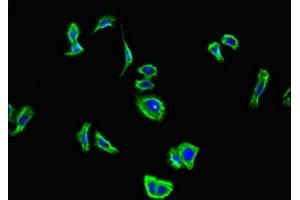 Immunofluorescent analysis of HepG2 cells using ABIN7146648 at dilution of 1:100 and Alexa Fluor 488-congugated AffiniPure Goat Anti-Rabbit IgG(H+L) (CNR2 anticorps  (AA 305-360))