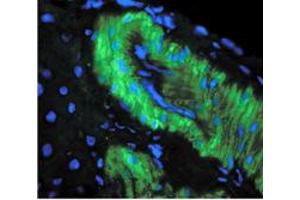 Image no. 1 for anti-Nitrotyrosine antibody (ABIN466935) (Nitrotyrosine anticorps)