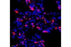 Immunofluorescence of paraffin embedded rat lung using MTND5 (ABIN7074659) at dilution of 1: 400 (400x lens)