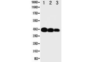 Western Blotting (WB) image for anti-Interleukin 12 beta (IL12B) (AA 23-40), (N-Term) antibody (ABIN3043199)