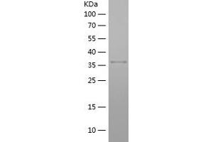 Western Blotting (WB) image for Heterogeneous Nuclear Ribonucleoprotein A3 (HNRNPA3) (AA 210-345) protein (His-IF2DI Tag) (ABIN7123322)