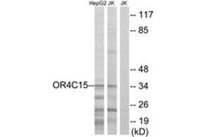 Western Blotting (WB) image for anti-Olfactory Receptor, Family 4, Subfamily C, Member 15 (OR4C15) (AA 261-310) antibody (ABIN2891004) (OR4C15 anticorps  (AA 261-310))