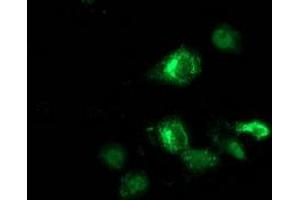 Anti-ANKRD53 mouse monoclonal antibody (ABIN2454354) immunofluorescent staining of COS7 cells transiently transfected by pCMV6-ENTRY ANKRD53 (RC206701). (ANKRD53 anticorps  (AA 1-300))