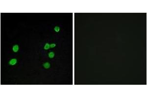 Immunofluorescence analysis of MCF7 cells, using p97 MAPK Antibody. (MAPK6 anticorps  (AA 461-510))