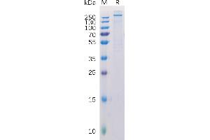 Human C Protein, His Tag on SDS-PAGE under reducing condition.