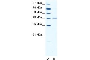 WB Suggested Anti-GABRA2 Antibody Titration:  1. (GABRA2 anticorps  (Middle Region))