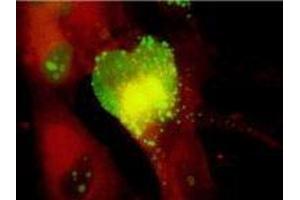 ELISA image for anti-Cytomegalovirus p65 (CMV p65) antibody (ABIN265537)