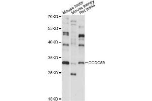 Western blot analysis of extracts of various cell lines, using CCDC59 antibody (ABIN6293275) at 1:1000 dilution. (CCDC59 anticorps)