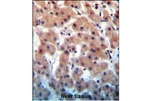 INHBB Antibody (C-term) (ABIN655083 and ABIN2844717) immunohistochemistry analysis in formalin fixed and paraffin embedded human liver tissue followed by peroxidase conjugation of the secondary antibody and DAB staining. (INHBB anticorps  (C-Term))