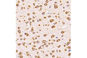 Immunohistochemistry analysis of paraffin-embedded mouse lung using,CLIC6 (ABIN7073478) at dilution of 1: 600