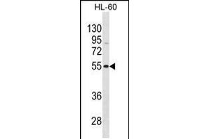 Western blot analysis in HL-60 cell line lysates (35ug/lane). (VIPR1 anticorps  (C-Term))